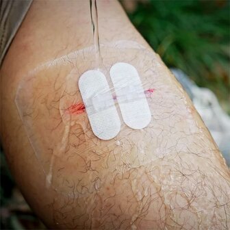 Rhino Rescue Zip Stitch wondsluitstrips zonder hechtdraad zelfklevend, Set 6 stuks