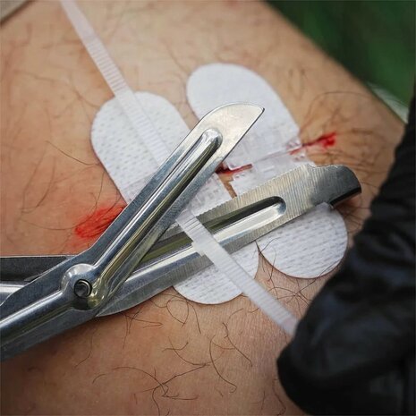 Rhino Rescue Zip Stitch wondsluitstrips zonder hechtdraad zelfklevend, Set 6 stuks